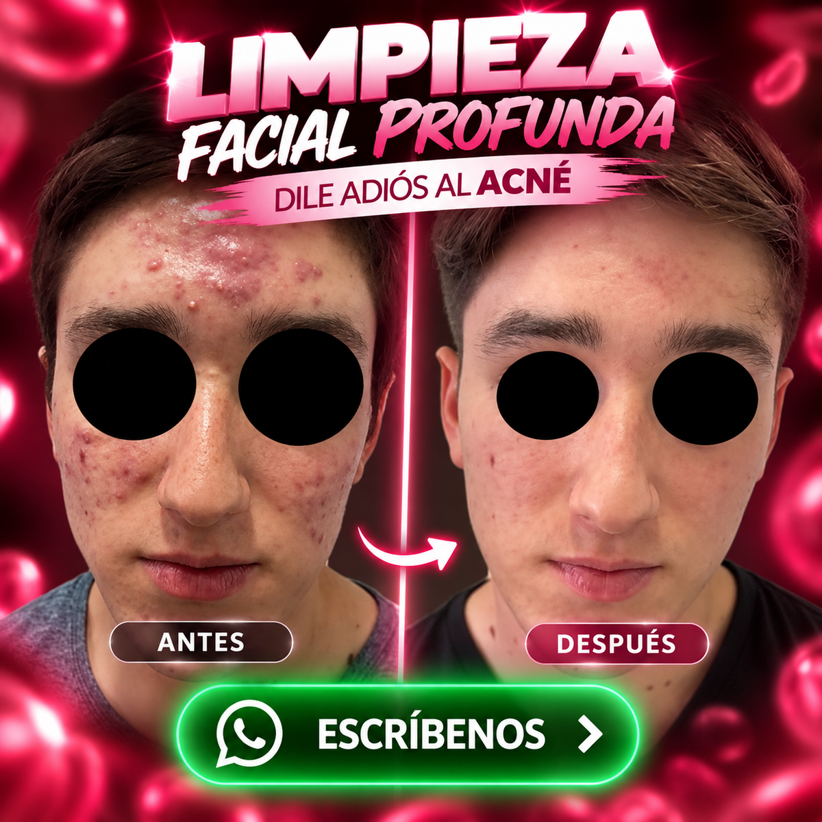 Limpieza Facial o Corporal