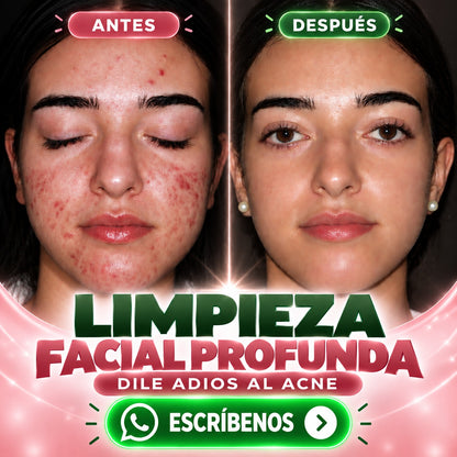 Limpieza Facial o Corporal
